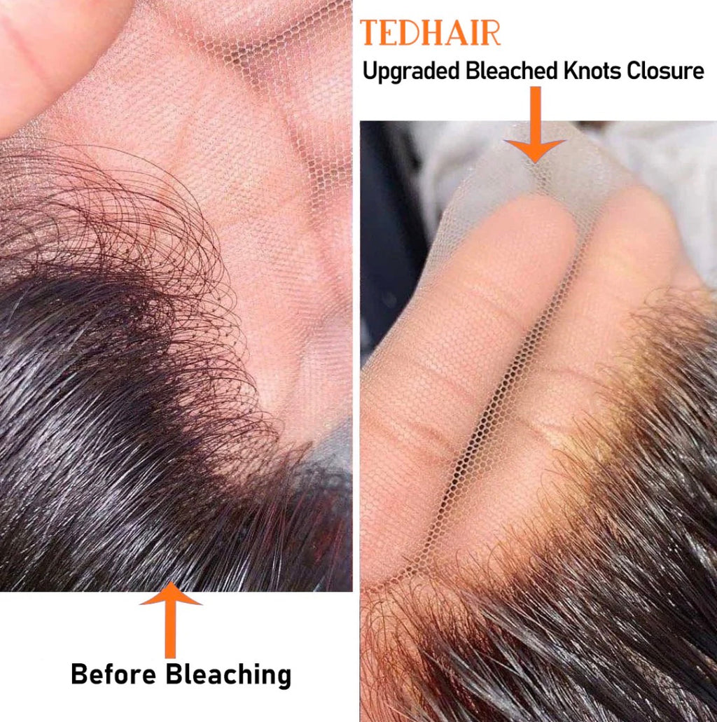 Body-ody-ody Closure